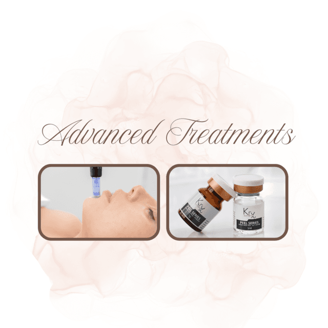 Skin Reset Package at JSM BEAUTY ROOM in Phoenix, AZ
